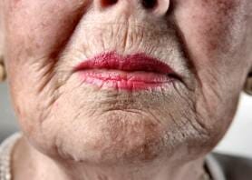 oma mond